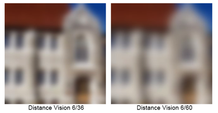 Distance Vision Acuity Image 6-60